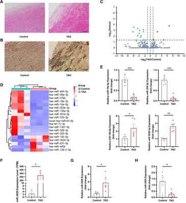 miR-3529-3p/ABCA1 axis regulates smooth muscle cell homeostasis by enhancing inflammation via JAK2/STAT3 pathway